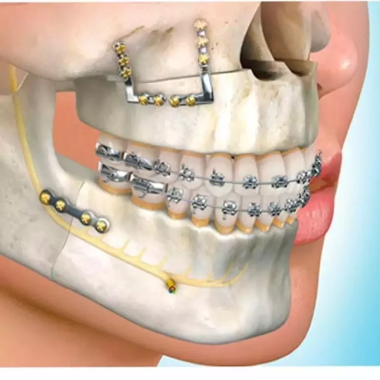 Odontologia Maxilofacial