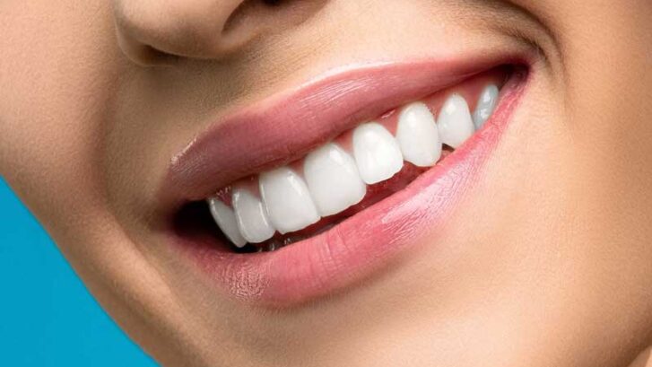 SONRISA PERFECTA: DESCUBRE LAS OPCIONES MODERNAS PARA CORREGIR PROBLEMAS ESTÉTICOS DENTALES